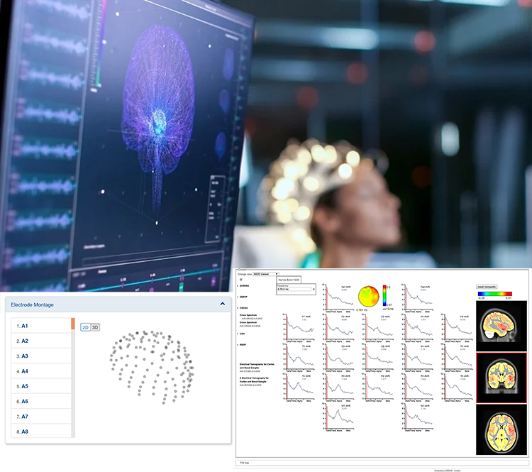 Infographic showing an eeg